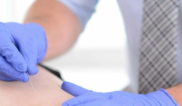 Dry Needling – Level 2 (Clearwater, FL)